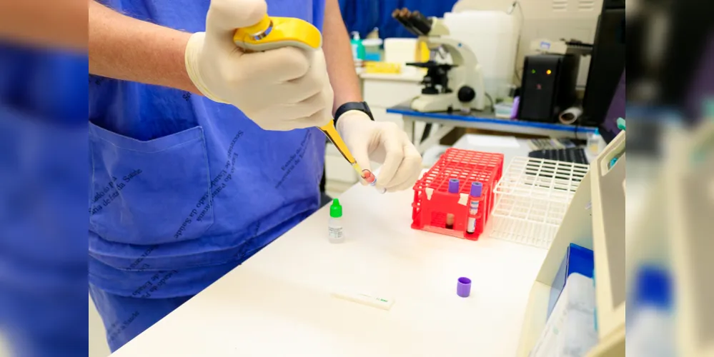 Os exames foram realizados em pacientes, contatos de casos positivos e profissionais da saúde